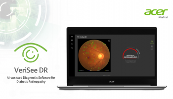 Acer Medical Inc. ร่วมกับ 4 โรงพยาบาล ทดลองใช้งาน Verisee DR ซอฟต์แวร์ วินิจฉัยภาวะเสี่ยงของโรคเบาหวานขึ้นจอประสาทตา
