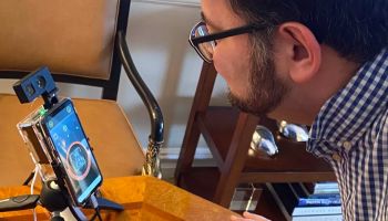 ระบบสแกนหน้า Face-Scanning รูปแบบใหม่ รองรับมือถือ 5G วิเคราะห์ถึงสภาพผิวหนังจริง "live skin" เหนือชั้นกว่าระบบ 3D