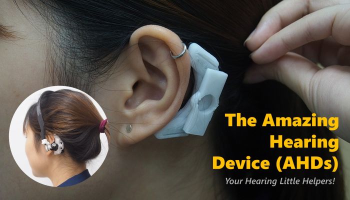 ทีม นศ.วิศวะมหิดล คิดค้นนวัตกรรม ‘เครื่องช่วยฟังมหัศจรรย์’  (AHDs) เพื่อผู้ป่วยทางการได้ยิน คว้ารางวัลนานาชาติ 