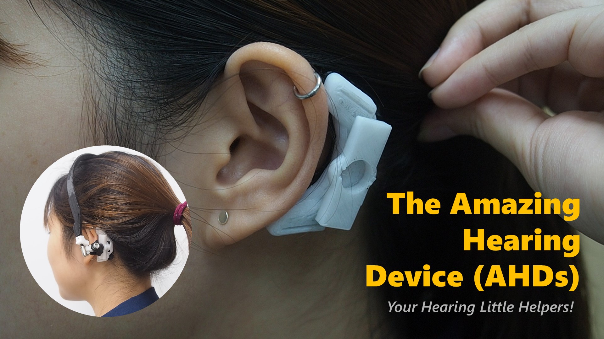 ทีม นศ.วิศวะมหิดล คิดค้นนวัตกรรม ‘เครื่องช่วยฟังมหัศจรรย์’  (AHDs) เพื่อผู้ป่วยทางการได้ยิน คว้ารางวัลนานาชาติ 